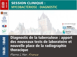 Diagnostic de la tuberculose : apport des nouveaux tests de laboratoire et nouvelle place de la radiographie thoracique