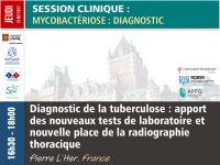 Diagnostic de la tuberculose : apport des nouveaux tests de laboratoire et nouvelle place de la radiographie thoracique