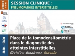 Place de la tomodensitométrie dans le diagnostic des atteintes interstitielles