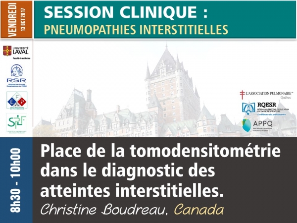 Place de la tomodensitométrie dans le diagnostic des atteintes interstitielles