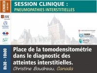 Place de la tomodensitométrie dans le diagnostic des atteintes interstitielles