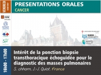 Intérêt de la ponction biopsie transthoracique échoguidée pour le diagnostic des masses pulmonaires
